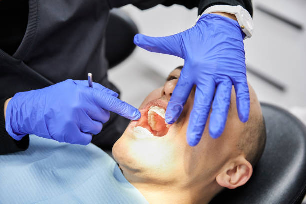 Best Emergency Denture Repair in Mango, FL